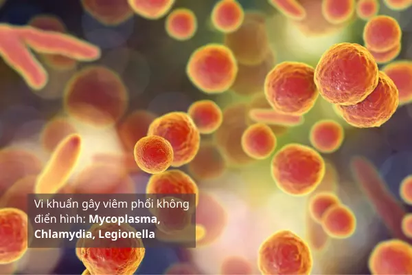 mycoplasma-chlamydia-legionella-la-ba-vi-khuan-pho-bien-gay-viem-phoi-khong-dien-hinh